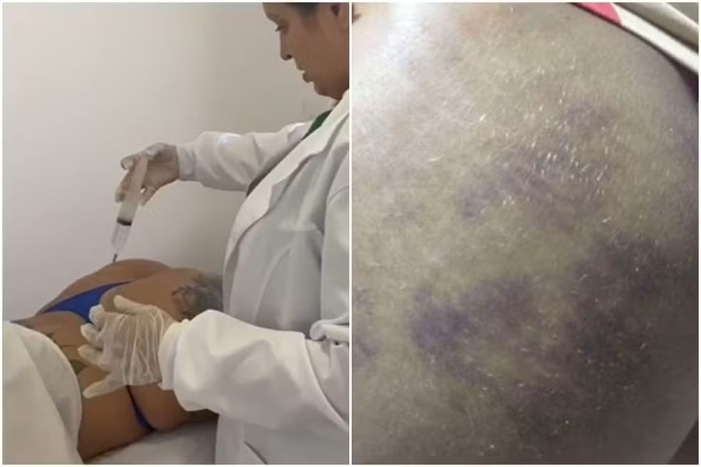 Mulheres no crime:  Falsa médica é presa pela Policia Civil em João Pessoa PB